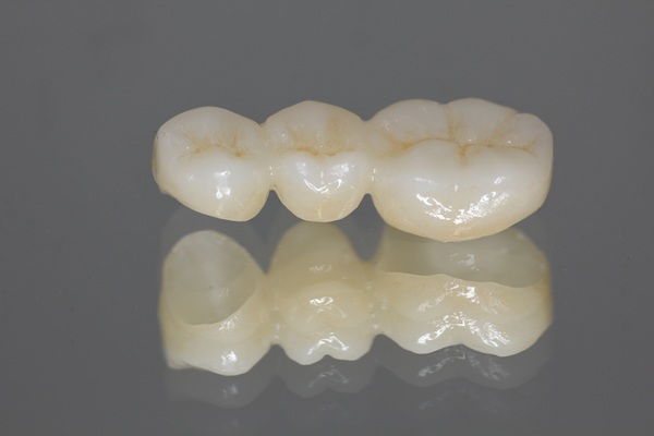 Ways Dental Bridges Can Restore Your Smile