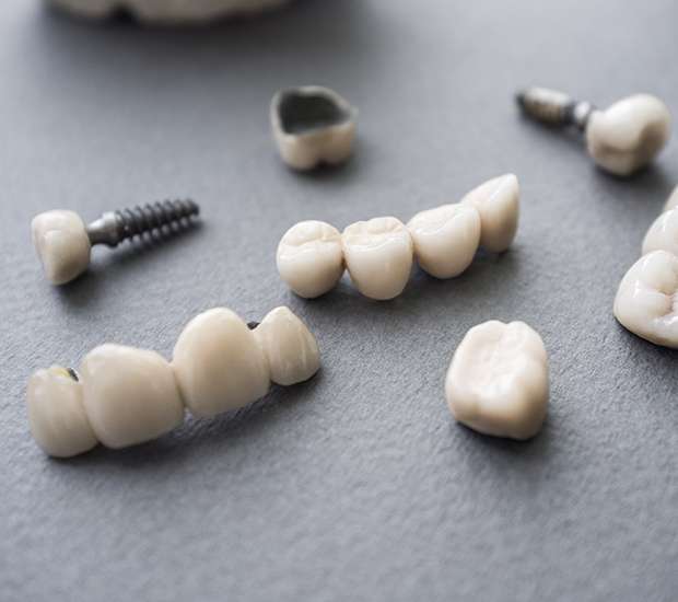 Murrieta The Difference Between Dental Implants and Mini Dental Implants