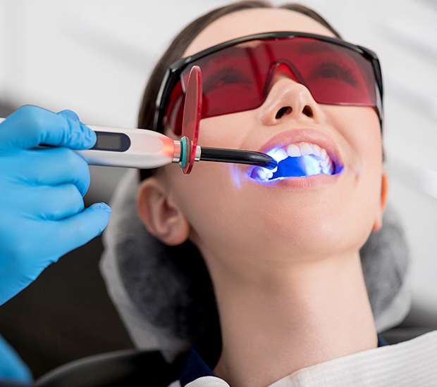 Murrieta Professional Teeth Whitening