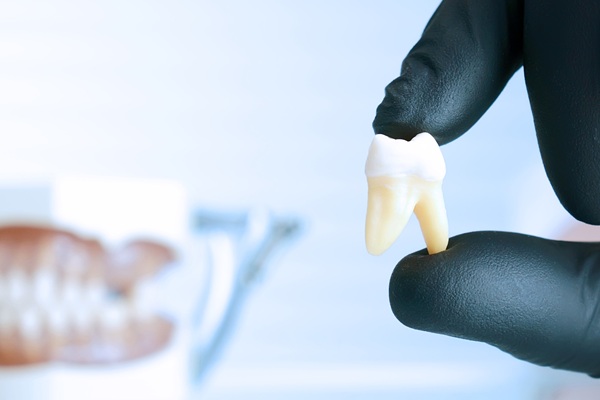 Common Myths And Facts About Wisdom Tooth Extraction